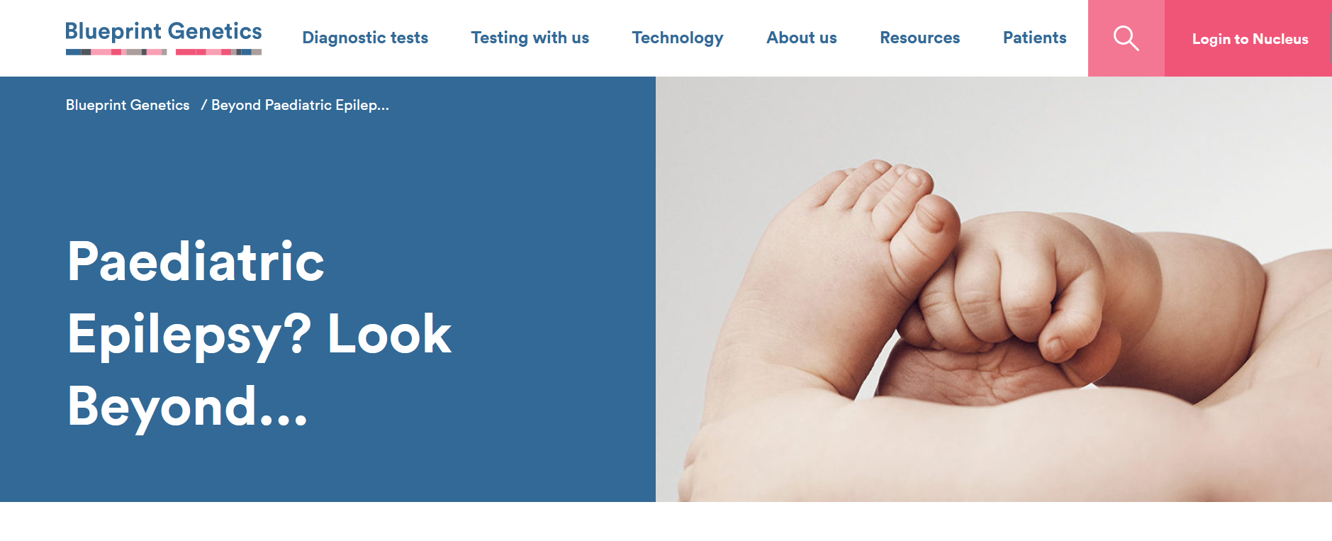 Beyond Pediatric Epilepsy Program.