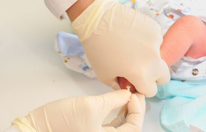 Cribado neonatal de AME.