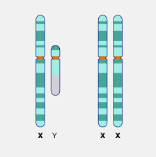 Enfermedades ligadas al X de especial relevancia neurogenética.
