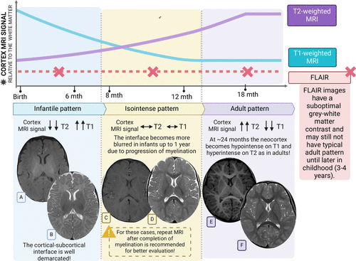 Neurorradiología básica para neuropediatras.